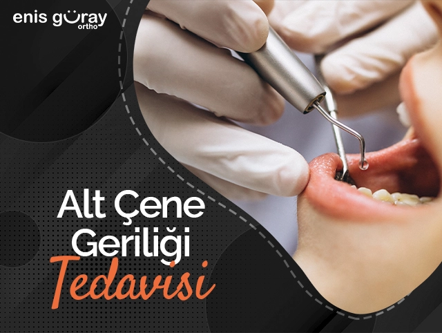 Alt Çene Geriliği Tedavisi