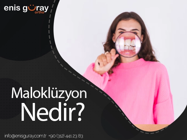 malokluzyon-nedir