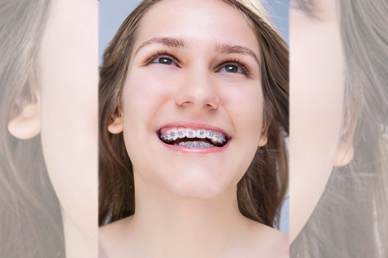 Ortodonti Çene Tedavisi