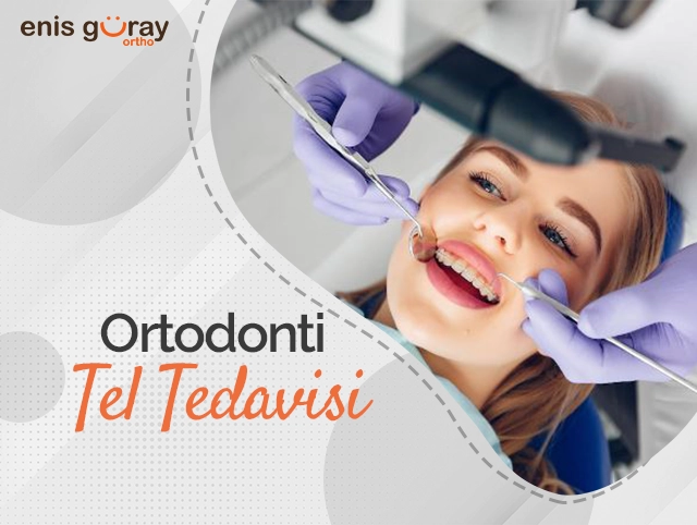 Ortodonti Tel Tedavisi
