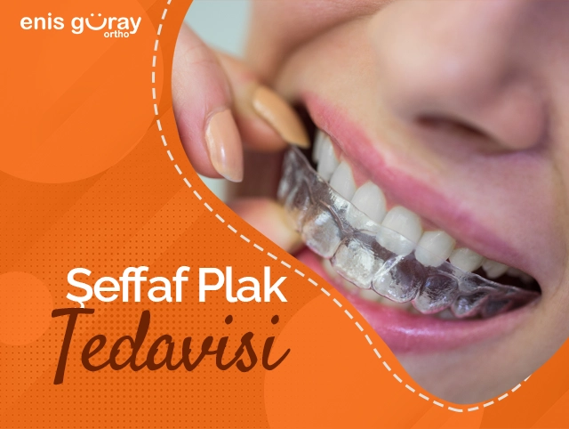 Şeffaf Plak Tedavisi