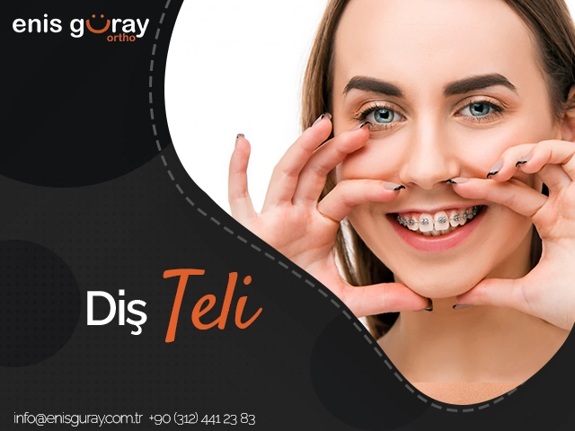 Diş Teli
