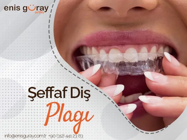 Şeffaf Diş Plağı