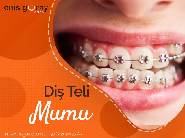 Diş Teli Mumu