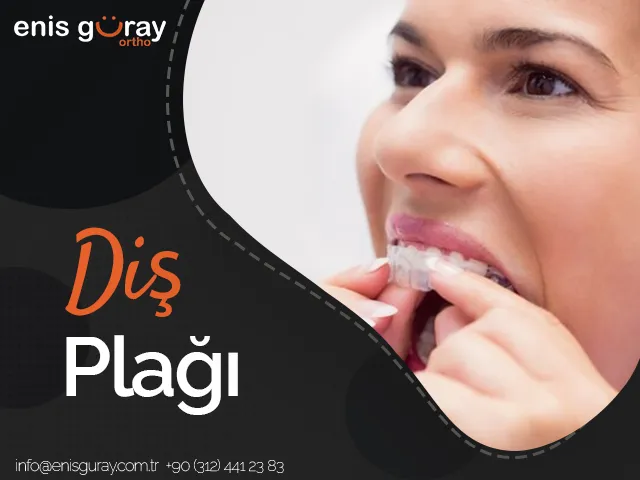 Diş Plağı