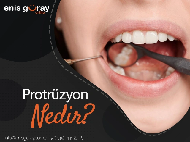 Protrüzyon Nedir