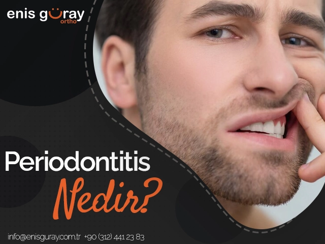 Periodontitis Nedir?