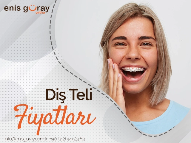 Diş Teli Fiyatları