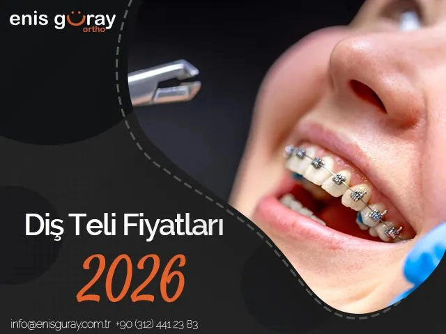 Diş Teli Fiyatları 2026