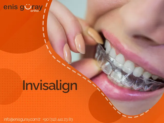 İnvisalign