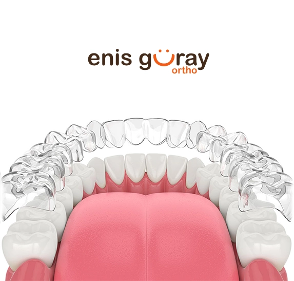 İnvisalign Ankara