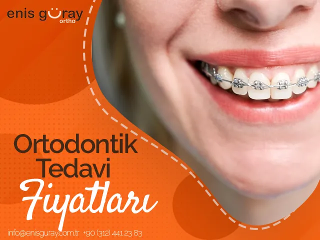 Ortodontik Tedavi Fiyatları