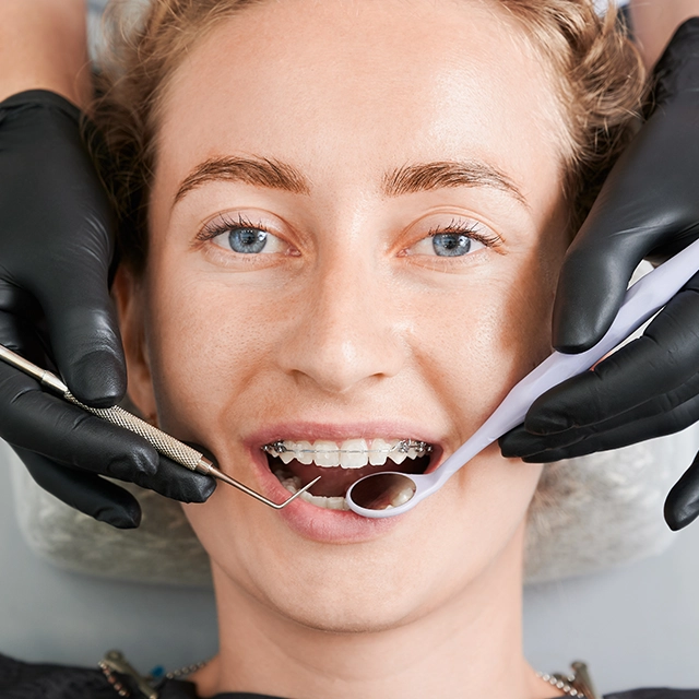 Retainer Teli
