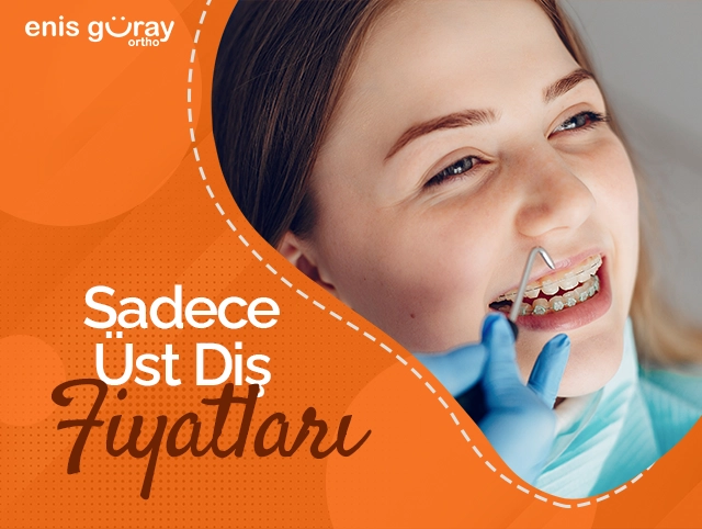 Sadece Üst Diş Teli Fiyatları