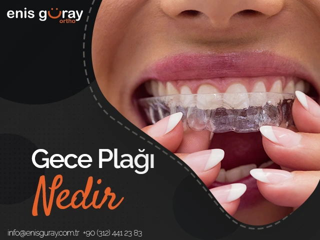 gece-plagi-nedir