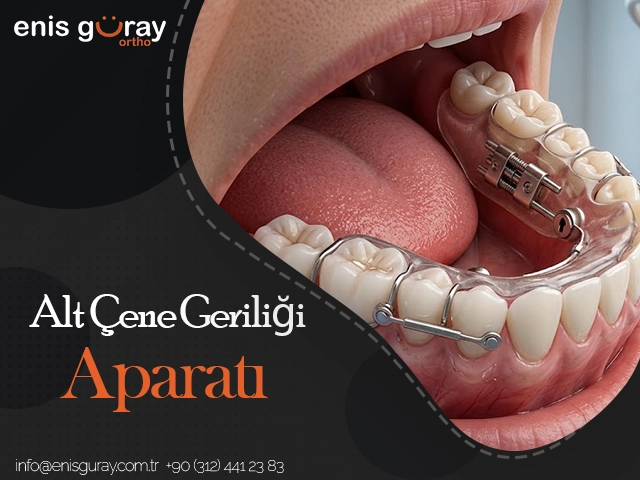 Alt Çene Geriliği Aparatı