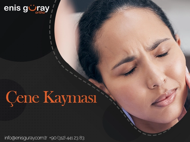 Çene Kayması